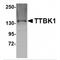 Tau Tubulin Kinase 1 antibody, MBS150715, MyBioSource, Western Blot image 