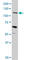 Mucin 4, Cell Surface Associated antibody, ab60720, Abcam, Western Blot image 