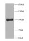 Progesterone Immunomodulatory Binding Factor 1 antibody, FNab06433, FineTest, Western Blot image 