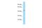 Beaded Filament Structural Protein 2 antibody, A09124, Boster Biological Technology, Western Blot image 