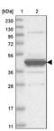 Epoxide Hydrolase 4 antibody, PA5-57140, Invitrogen Antibodies, Western Blot image 