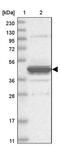 Epoxide Hydrolase 4 antibody, PA5-57140, Invitrogen Antibodies, Western Blot image 