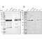 Ubiquinol-Cytochrome C Reductase Core Protein 2 antibody, NBP1-80861, Novus Biologicals, Western Blot image 