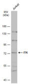 IL2 Inducible T Cell Kinase antibody, GTX113215, GeneTex, Western Blot image 
