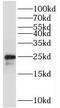 TMEM9 Domain Family Member B antibody, FNab08794, FineTest, Western Blot image 