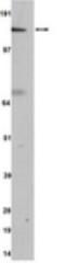 Rho Associated Coiled-Coil Containing Protein Kinase 2 antibody, NBP2-29776, Novus Biologicals, Western Blot image 