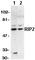 Receptor Interacting Serine/Threonine Kinase 2 antibody, ab8428, Abcam, Western Blot image 