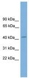 Visual system homeobox 1 antibody, TA329972, Origene, Western Blot image 