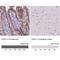 Cadherin 1 antibody, NBP2-34477, Novus Biologicals, Immunohistochemistry paraffin image 