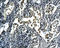 Serpin Family F Member 1 antibody, 250819, Abbiotec, Immunohistochemistry paraffin image 
