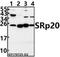 Serine And Arginine Rich Splicing Factor 3 antibody, GTX66685, GeneTex, Western Blot image 