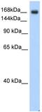 Sodium Voltage-Gated Channel Alpha Subunit 5 antibody, ab56240, Abcam, Western Blot image 