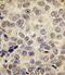 DNA Methyltransferase 3 Beta antibody, PA5-11161, Invitrogen Antibodies, Immunohistochemistry frozen image 