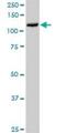 Tyrosine Kinase 2 antibody, H00007297-D01P, Novus Biologicals, Western Blot image 