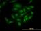 PDZ Binding Kinase antibody, H00055872-M11, Novus Biologicals, Immunocytochemistry image 