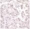 Mtr4 Exosome RNA Helicase antibody, NB100-1574, Novus Biologicals, Immunohistochemistry paraffin image 