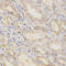 Golgi Associated, Gamma Adaptin Ear Containing, ARF Binding Protein 2 antibody, LS-C331330, Lifespan Biosciences, Immunohistochemistry frozen image 