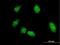 Retroviral integration site protein Fli-1 antibody, H00002313-M05, Novus Biologicals, Immunocytochemistry image 