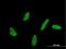 Ubiquitin Conjugating Enzyme E2 U antibody, H00148581-M07, Novus Biologicals, Immunocytochemistry image 