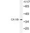 Carbonic Anhydrase 5B antibody, LS-C177357, Lifespan Biosciences, Western Blot image 