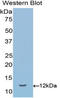 Semaphorin 3E antibody, LS-C297389, Lifespan Biosciences, Western Blot image 