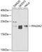 Pleckstrin Homology Like Domain Family A Member 2 antibody, GTX54573, GeneTex, Western Blot image 