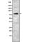 Ribosomal Protein S6 Kinase A2 antibody, abx218379, Abbexa, Western Blot image 