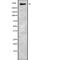 Zinc Finger Homeobox 4 antibody, PA5-67675, Invitrogen Antibodies, Western Blot image 