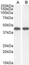 Argininosuccinate Synthase 1 antibody, 46-626, ProSci, Enzyme Linked Immunosorbent Assay image 