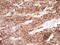 Protein C Receptor antibody, LS-C790637, Lifespan Biosciences, Immunohistochemistry paraffin image 