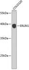 ER Lipid Raft Associated 1 antibody, 19-370, ProSci, Western Blot image 