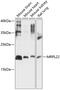 Mitochondrial Ribosomal Protein L22 antibody, 15-617, ProSci, Western Blot image 