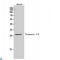 Troponin I3, Cardiac Type antibody, LS-C813531, Lifespan Biosciences, Western Blot image 