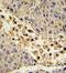 Collectin Subfamily Member 11 antibody, GTX81694, GeneTex, Immunohistochemistry paraffin image 