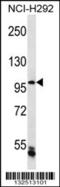 Chromosome transmission fidelity protein 18 homolog antibody, 56-780, ProSci, Western Blot image 
