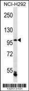 Chromosome Transmission Fidelity Factor 18 antibody, 56-780, ProSci, Western Blot image 