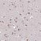 Downstream Neighbor Of SON antibody, NBP2-38599, Novus Biologicals, Immunohistochemistry frozen image 