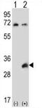 Testis Specific Serine Kinase 6 antibody, AP54390PU-N, Origene, Western Blot image 
