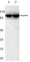 Androgen Receptor antibody, PA5-36617, Invitrogen Antibodies, Western Blot image 