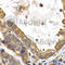 Glycogen Synthase 1 antibody, A2519, ABclonal Technology, Immunohistochemistry paraffin image 