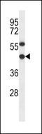 EBNA1 Binding Protein 2 antibody, 56-573, ProSci, Western Blot image 