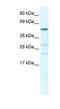 Heat Shock Transcription Factor Y-Linked 2 antibody, NBP1-80129, Novus Biologicals, Western Blot image 