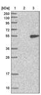 Galactosidase Beta 1 antibody, NBP1-88328, Novus Biologicals, Western Blot image 