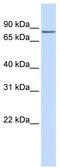 Zinc Finger Protein 420 antibody, TA342540, Origene, Western Blot image 