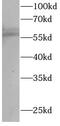 RORgt antibody, FNab10046, FineTest, Western Blot image 