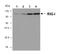 DExD/H-Box Helicase 58 antibody, NBP2-80055, Novus Biologicals, Western Blot image 