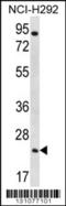 Aquaporin 5 antibody, 56-334, ProSci, Western Blot image 