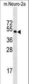 Serine/Threonine Kinase 39 antibody, LS-C158271, Lifespan Biosciences, Western Blot image 