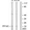 Protein Phosphatase 1 Regulatory Inhibitor Subunit 14C antibody, PA5-49854, Invitrogen Antibodies, Western Blot image 