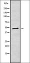 Insulin Like Growth Factor Binding Protein 4 antibody, orb337754, Biorbyt, Western Blot image 